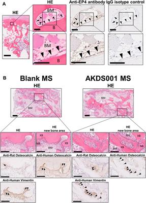 Prostaglandin EP4 Selective Agonist AKDS001 Enhances New Bone Formation by Minimodeling in a Rat Heterotopic Xenograft Model of Human Bone